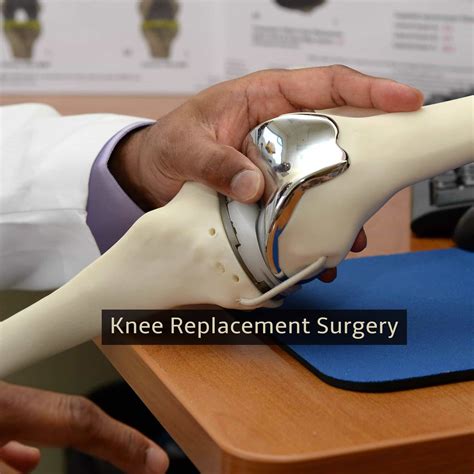 Knee Surgery In Greenwich .